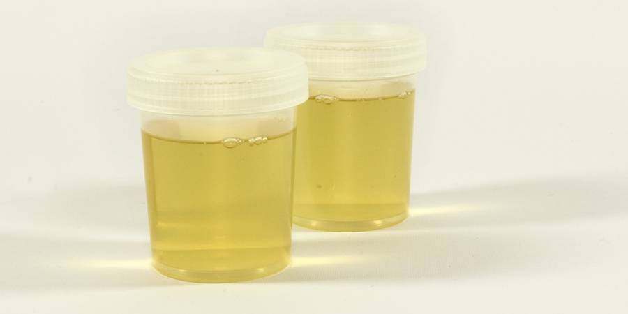 The Psychology Behind Fetish Urine Fantasies